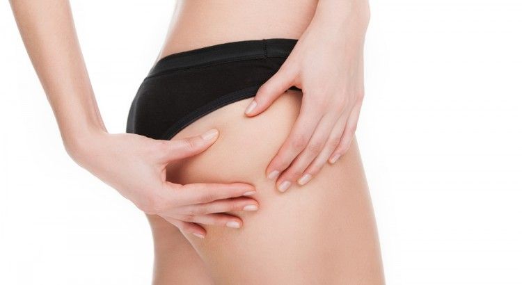 Trattare la cellulite: 45 minuti per risultati efficaci