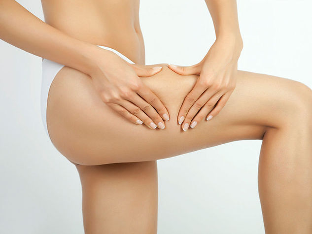 Eliminare la cellulite