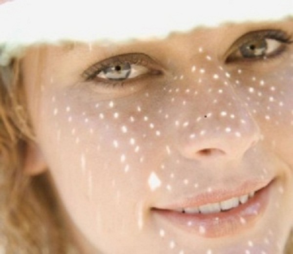 Il laser per le macchie del viso è efficace?