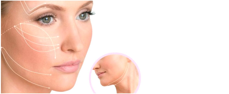 Lifting viso senza bisturi: la tecnologia degli ultrasuoni microfocalizzati