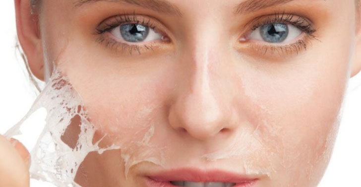 Il peeling chimico viso