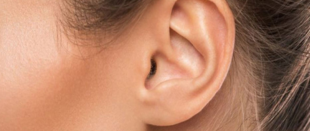 Lobo orecchio e chirurgia estetica