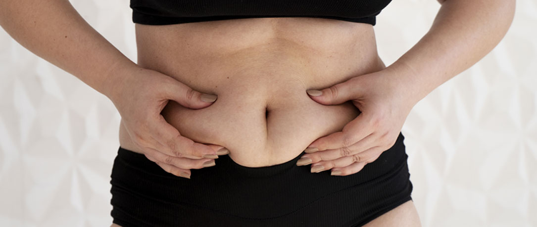 Bypass gastrico, i pro e i contro