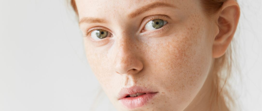 Come eliminare le macchie dal viso?