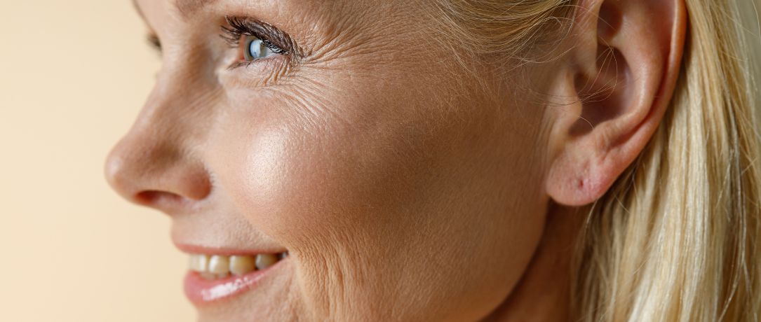 Neuromodulazione estetica per un espressione rilassata e naturale