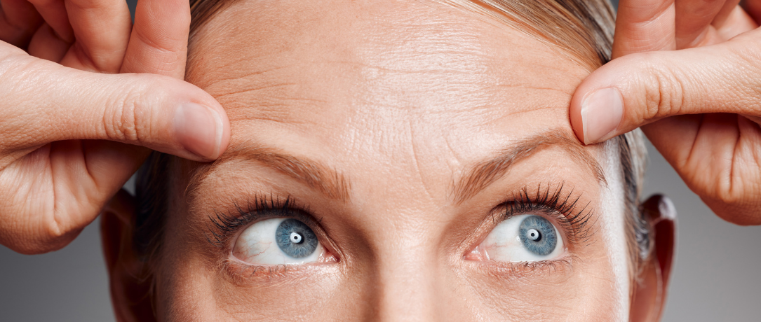 Rughe d’espressione addio: il trattamento che rilassa il viso senza stravolgerlo