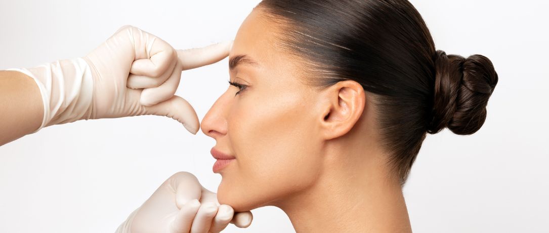 Rinoplastica secondaria: quando rifare il naso e cosa aspettarsi